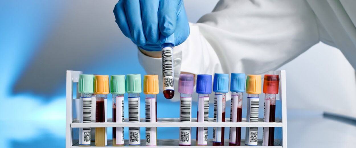 Close up of medical personnel picking up a vile of blood amongst numerous other viles of blood