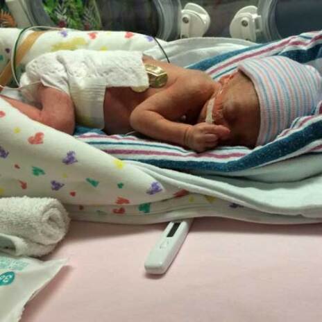 Newborn baby in NICU